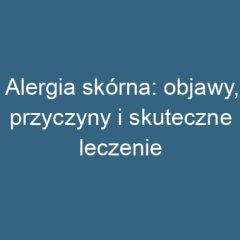 Alergia skórna: objawy, przyczyny i skuteczne leczenie