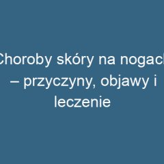 Choroby skóry na nogach – przyczyny, objawy i leczenie