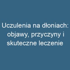 Uczulenia na dłoniach: objawy, przyczyny i skuteczne leczenie