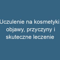 Uczulenie na kosmetyki: objawy, przyczyny i skuteczne leczenie