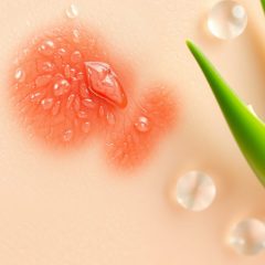 Wysyp po retinolu: dlaczego się pojawia i jak bezpiecznie złagodzić podrażnienia skóry